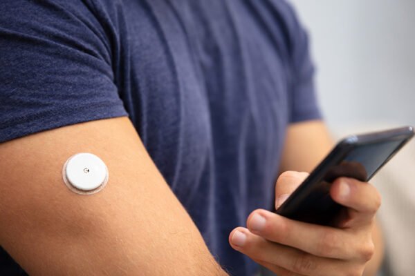 CGM Data in a Diet Controlled Diabetic